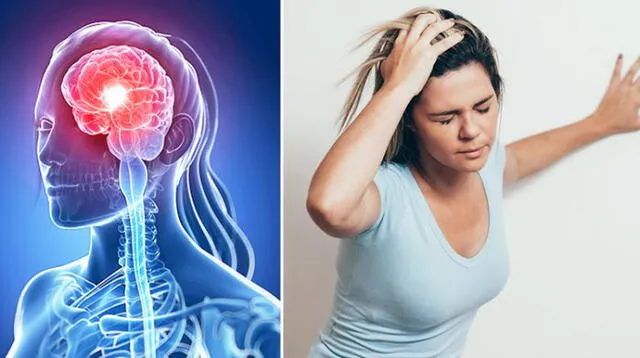 Mucho cuidado El Accidente Cerebrovascular (ACV), conocido en el país como “derrame cerebral”.