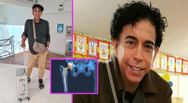 Ernesto Pimentel se sometió a cirugía para caminar sin apoyo de un bastón.