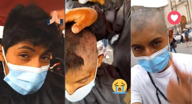 Noble acto. El joven de Arequipa se grabó el antes y después luego de raparse todo el cabello.