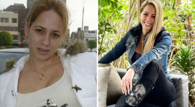 Este es el antes y después de Melissa Klug.