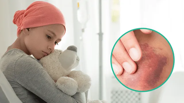 La leucemia se puede prevenir durante las visitas anuales al pediatra.