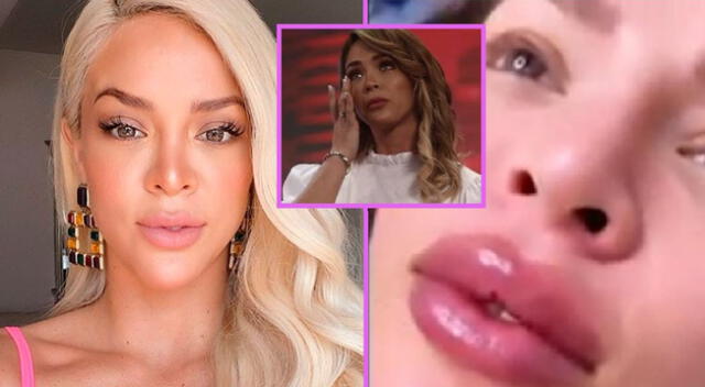 Sheyla Rojas revela su estado de salud tras críticas a sus labios.