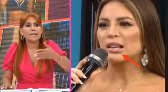 Magaly Medina aconseja a Sheyla Rojas demandar a cirujano.