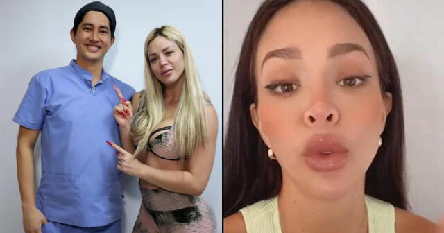 Cirujano explica por qué cara de Sheyla Rojas está afectada.