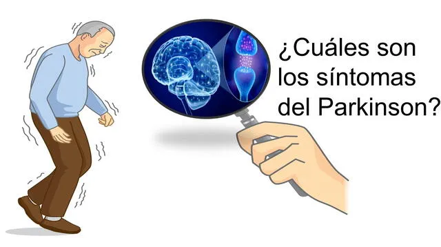 Conoce cuáles son los síntomas del Parkinson