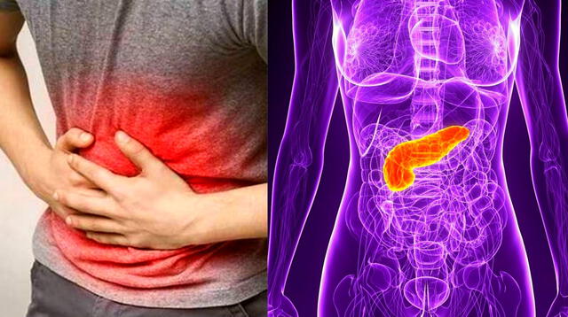 Los síntomas del cáncer de páncreas aparecen  generalmente tarde.