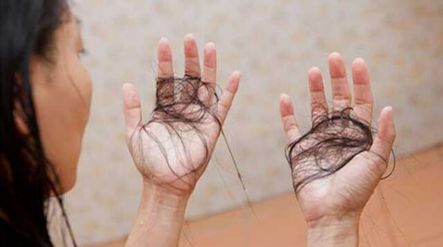 La pérdida de cabello tras haber sufrido COVID-19.