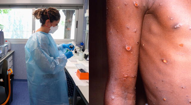 Hombre presenta lesiones dérmicas y manchas en la piel.