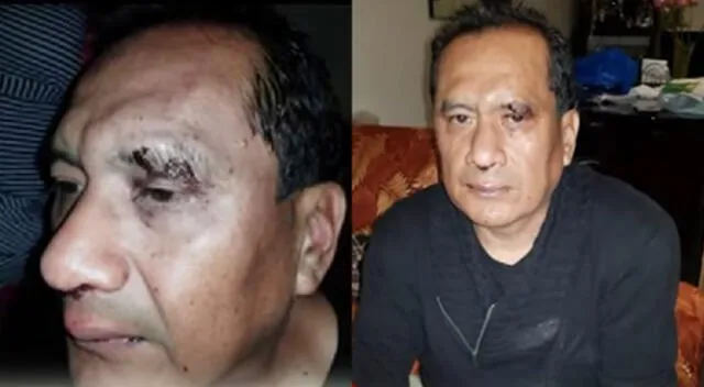 Hombre agredido en el rostro por sus secuestradores