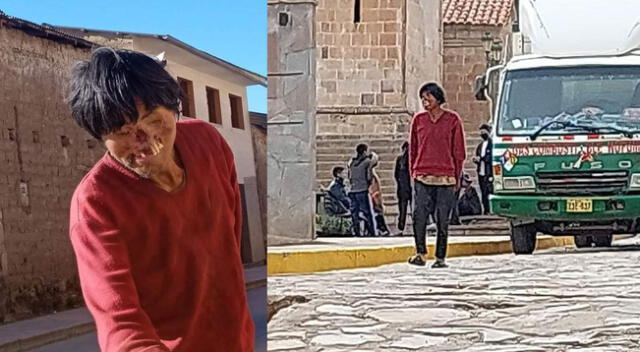 Joven sufre de extraña enfermedad en el rostro.