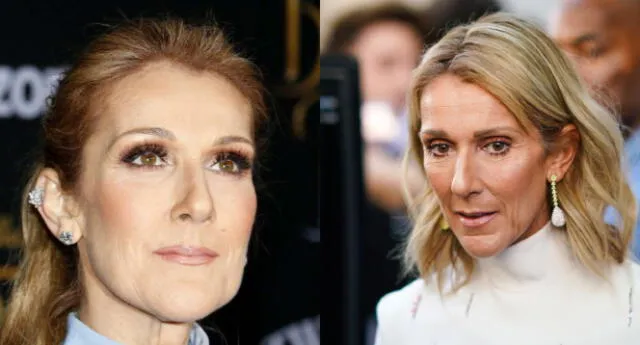 Celine Dion envió un mensaje en francés e inglés contando que sufre de síndrome de la persona rígida.