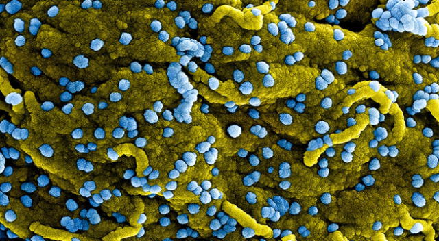 La infección humana por virus de Marburgo puede ser el resultado de una exposición prolongada en minas.