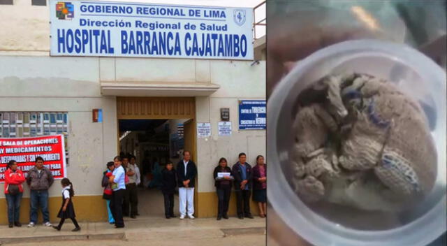 Gasa dejada dentro de cuerpo de mujer en Barranca.