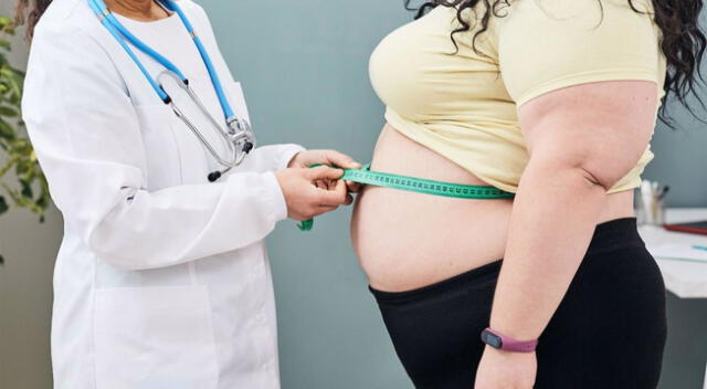 La cirugía bariátrica es una opción para combatir la obesidad.