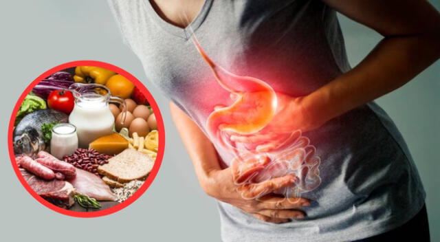 La gastritis es la inflamación aguda o crónica de la mucosa que recubre las paredes del estómago.