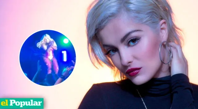 La cantante Bebe Rexha quedó con un terrible golpe tras recibir el impacto de un teléfono en su ojo izquierdo.