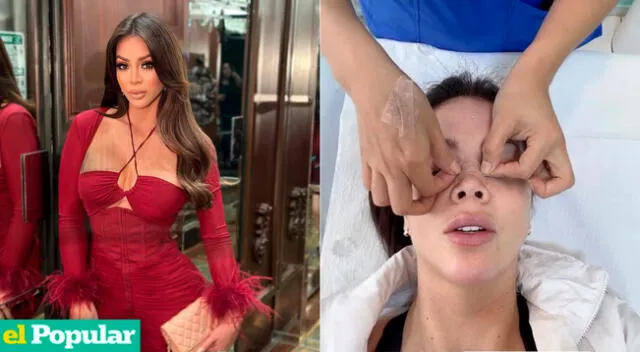 Sheyla Rojas afirma estar feliz con su nueva rinoplastia.