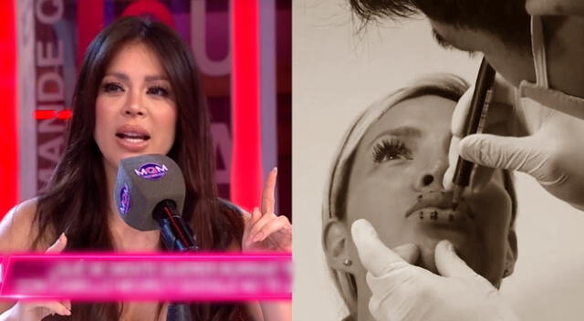 Sheyla Rojas considera que 'abuso' de los retoquitos por culpa del canje.