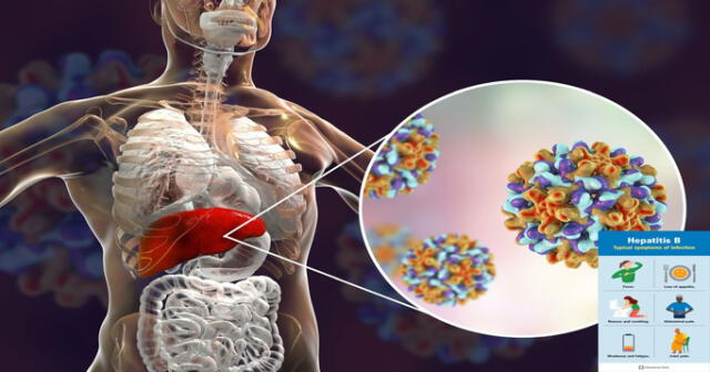 La hepatitis B es una infección transmisible.