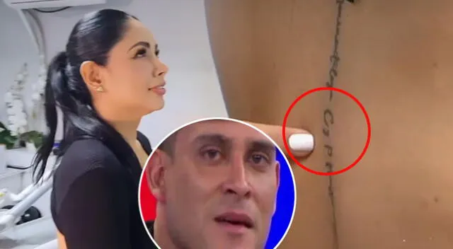 Pamela Franco se borra tatuaje de Christian Domínguez.