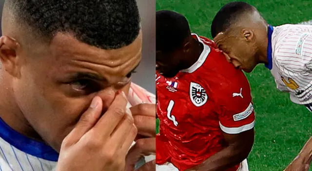 Kylian Mbappé sufrió un duro golpe tras chocar con un defensor de Austria.