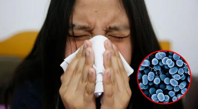 'Bacteria asesina' invade las fosas nasales. Minsa recomienda acudir al médico.