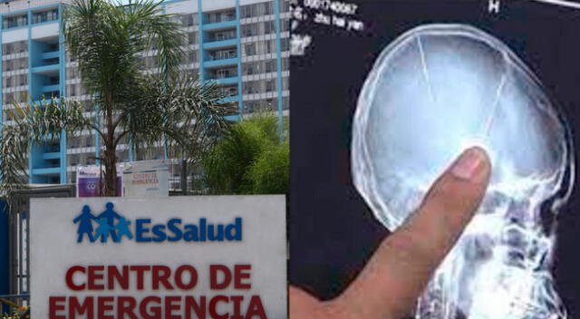 EsSalud emitió comunicado sobre el estado de salud del menor de edad.