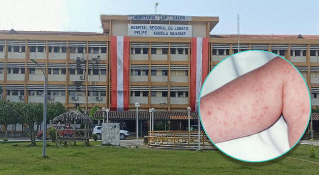 Seis estudiante de nivel secundario en Loreto, habrían sido diagnosticados con el meningocóco.