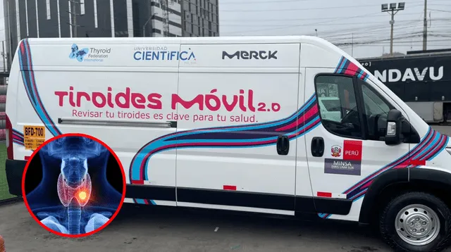 La primera movilidad en el Perú que llevará despistajes gratuitos para la detección de enfermedades tiroideas.