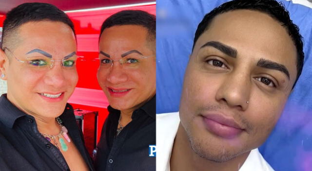 Jonathan Maicelo se sometió a nuevos tratamientos estéticos.