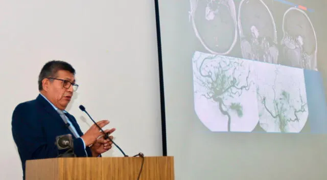 IPEN impulsará innovadora terapia con boro para tratar tumores cerebrales IPEN impulsará innovadora terapia con boro para tratar tumores cerebrales