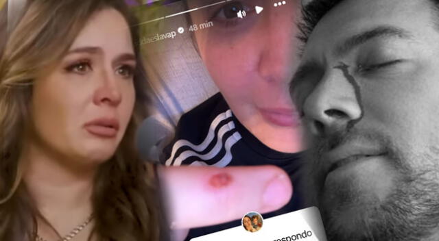 Yiddá Eslava aparece con CORTES y HERIDAS tras fuertes imágenes de Julián Zucchi ENSANGRENTADO tras visitar su casa. Yiddá Eslava aparece con CORTES y HERIDAS tras fuertes imágenes de Julián Zucchi ENSANGRENTADO tras visitar su casa.