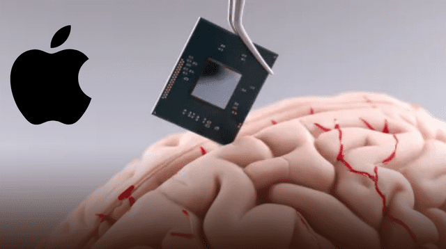 Este avance marca un hito en la neurotecnología. Este avance marca un hito en la neurotecnología.