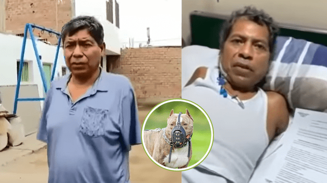 Pitbulls destrozan la vida de un peruano: sin brazos, en coma y sin respuesta legal. Pitbulls destrozan la vida de un peruano: sin brazos, en coma y sin respuesta legal.