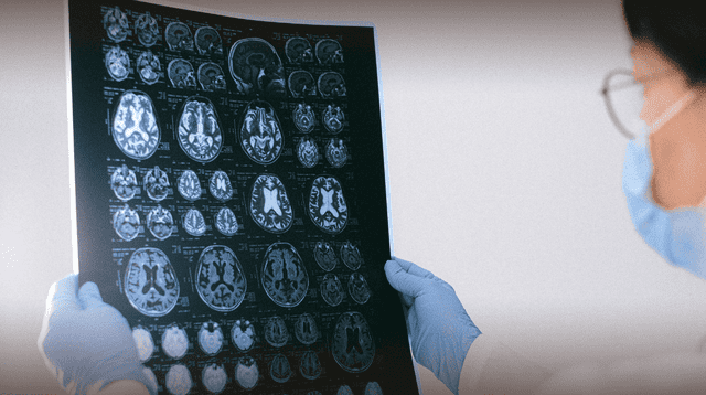Científicos identifican patrones cerebrales únicos en personas con rasgos psicopatas. Científicos identifican patrones cerebrales únicos en personas con rasgos psicopatas.