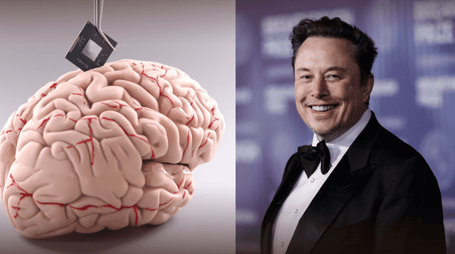 Elon Musk promete devolver la visión con chips cerebrales de Neuralink.