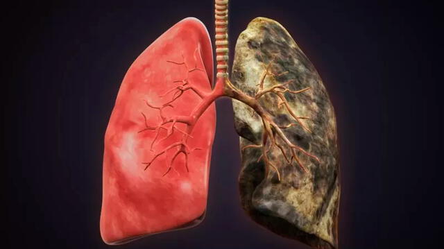 OMS informa que el tabaco, en cualquiera de sus formas, es dañino para la salud. / FUENTE: Getty Images. 