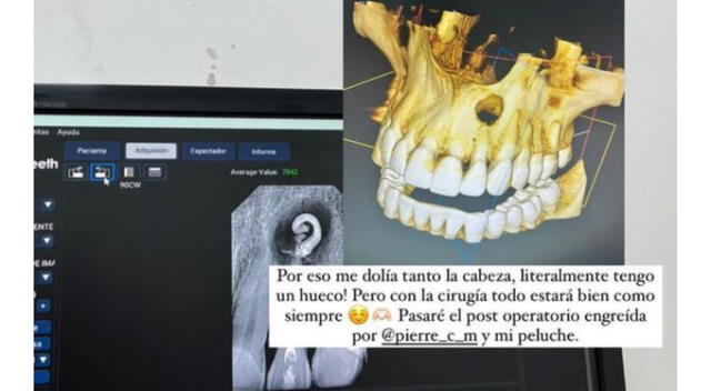 Valeria Piazza comparte imágenes de su enfermedad. Fuente: Instagram.