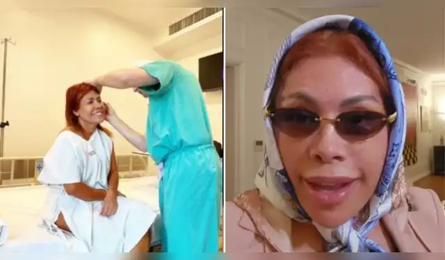 Magaly Medina antes y después de su operación. Fuente: Instagram.