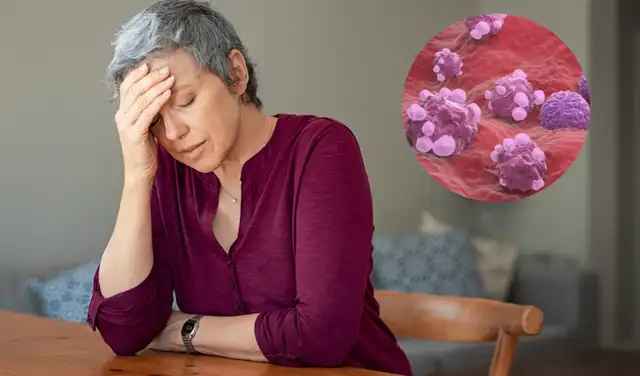 menopausia menopausia