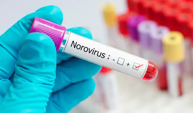 norovirus norovirus