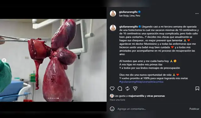 Giuliana Rengifo revela delicada cirugía