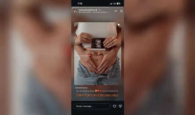 Melissa Klug tiene emocionante reacción ante primer embarazo de Gianella Marquina