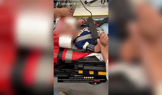 Pequeño hijo de la actriz sufrió accidente