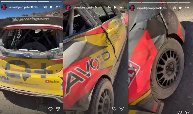 Samuel, el hijo de María Pía Copello y Samuel Dyer, contó en redes sociales los detalles de su accidente. Foto: captura Instagram