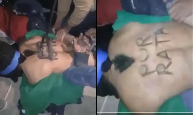 Hombres queman a ladrón con fierro de ganado y le dejan un mensaje en la espalda
