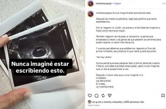 Influencer Rocio Marquez confiesa en una publicación que perdió su embarazo.