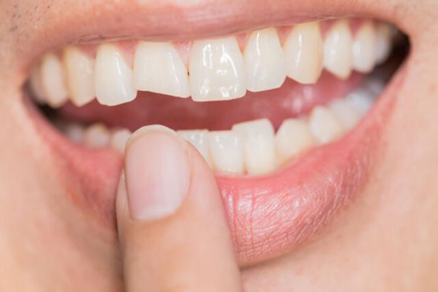  soñar con un diente flojo simboliza pérdida personal. 