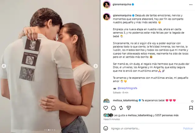 Gianella Marquina, hija mayor de Melissa Klug, anuncia su PRIMER EMBARAZO: 