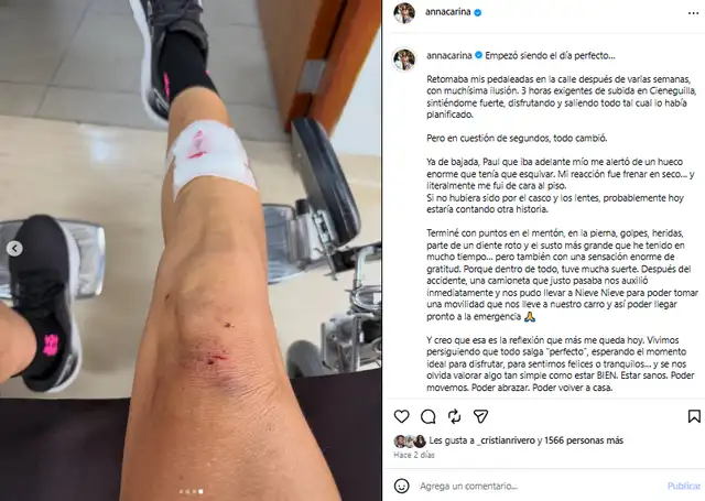 Hermana de María Pía Copello sufrió fuerte accidente.